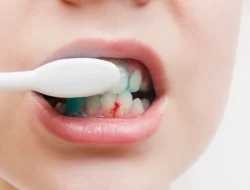 Kesalahan Umum Saat Menghadapi Gusi Berdarah: Panduan Lengkap untuk Kesehatan Mulut Optimal