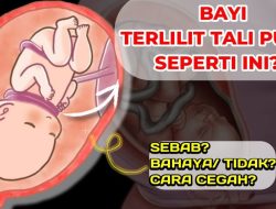 Apakah tali pusat melilit leher janin berbahaya